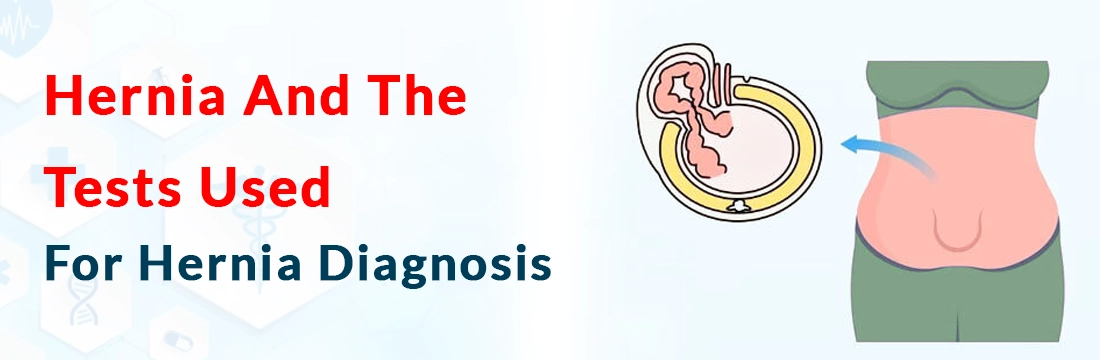  Hernia And The Tests Used For Hernia Diagnosis